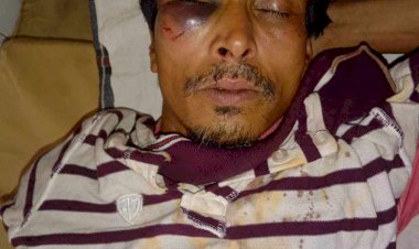 নরসিংদীর শিবপুরে জোর পূর্বক জমিতে বাউন্ডারি ওয়াল নির্মাণ করতে বাধা দেয়ায় হামলা করে দুইজনকে গুরুতর জখম করার অভিযোগ পাওয়া গেছে