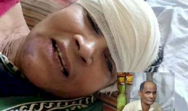 দেবরের পরিবারের হামলায় আহত অঞ্জলি রানী হাসপাতালে