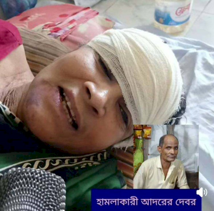 দেবরের পরিবারের হামলায় আহত অঞ্জলি রানী হাসপাতালে