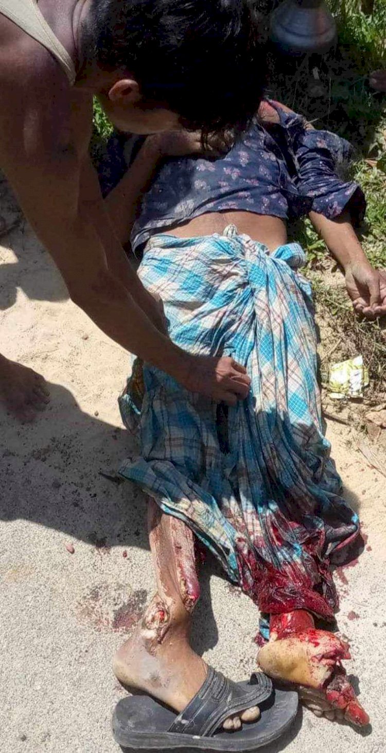 নাইক্ষ্যংছড়ি'র ঘুমধুম সড়ক দুর্ঘটনায় রতন বড়ুয়া নামক ১জন নিহত!