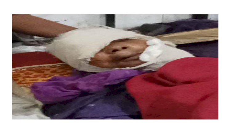 নওগাঁর মহাদেবপুরে শিয়ালের কামড়ে আহত-৫
