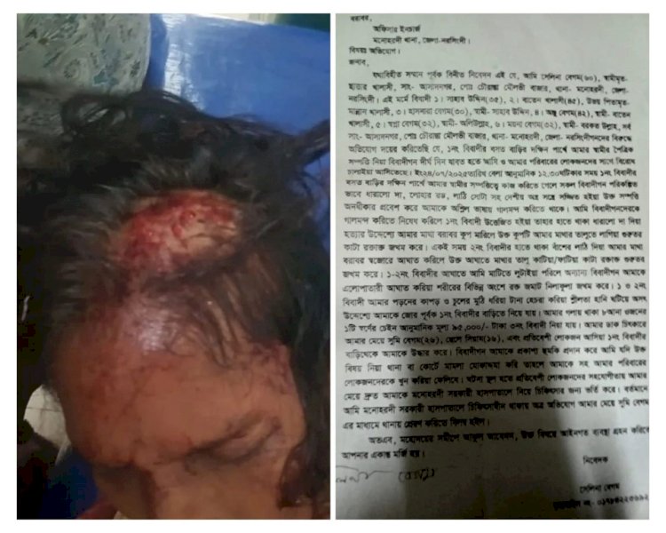 মনোহরদীতে  জমি সংক্রান্ত বিরোধের জেরে গুরুতর আহত -১